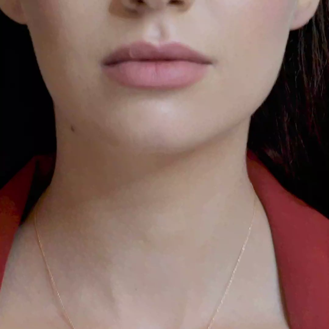 18 K Rose Gold Amethyst